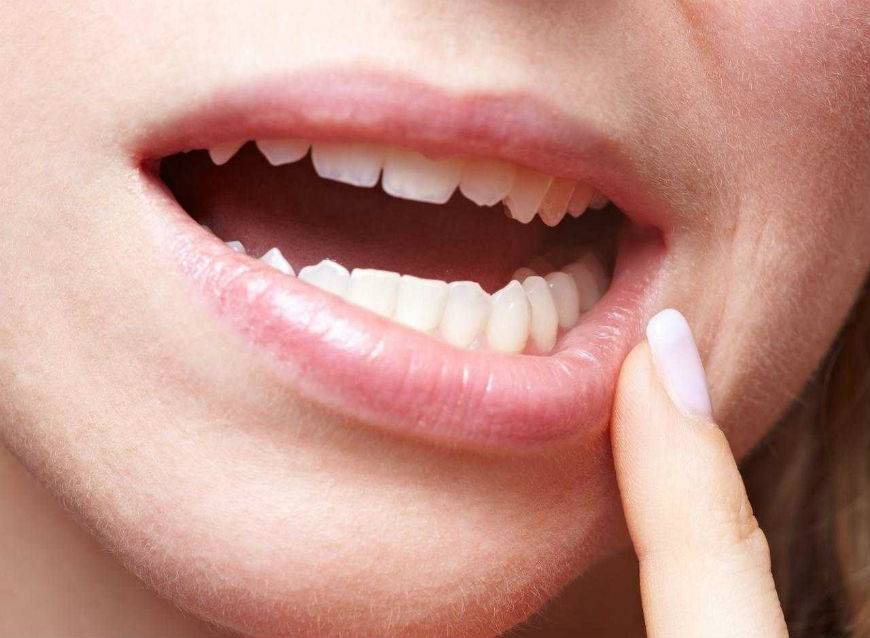 Подвижность зубов | «СМ-Стоматология»
