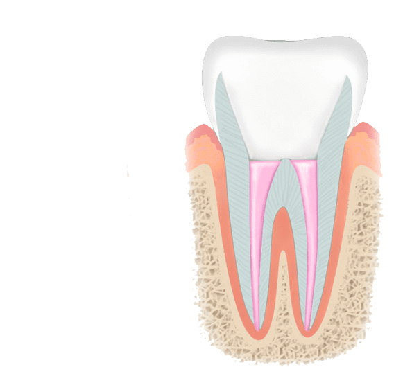 Цвет зубов — от серого до белого